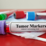 tumor markers